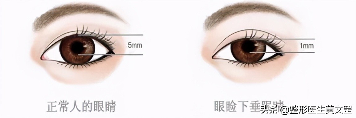 王世勇什么样的眼睛是美的,什么样子的眼睛才好看