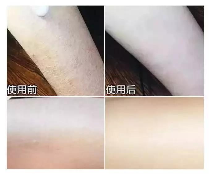 保湿的身体乳公认最好用,抹了身体乳皮肤干燥起皮