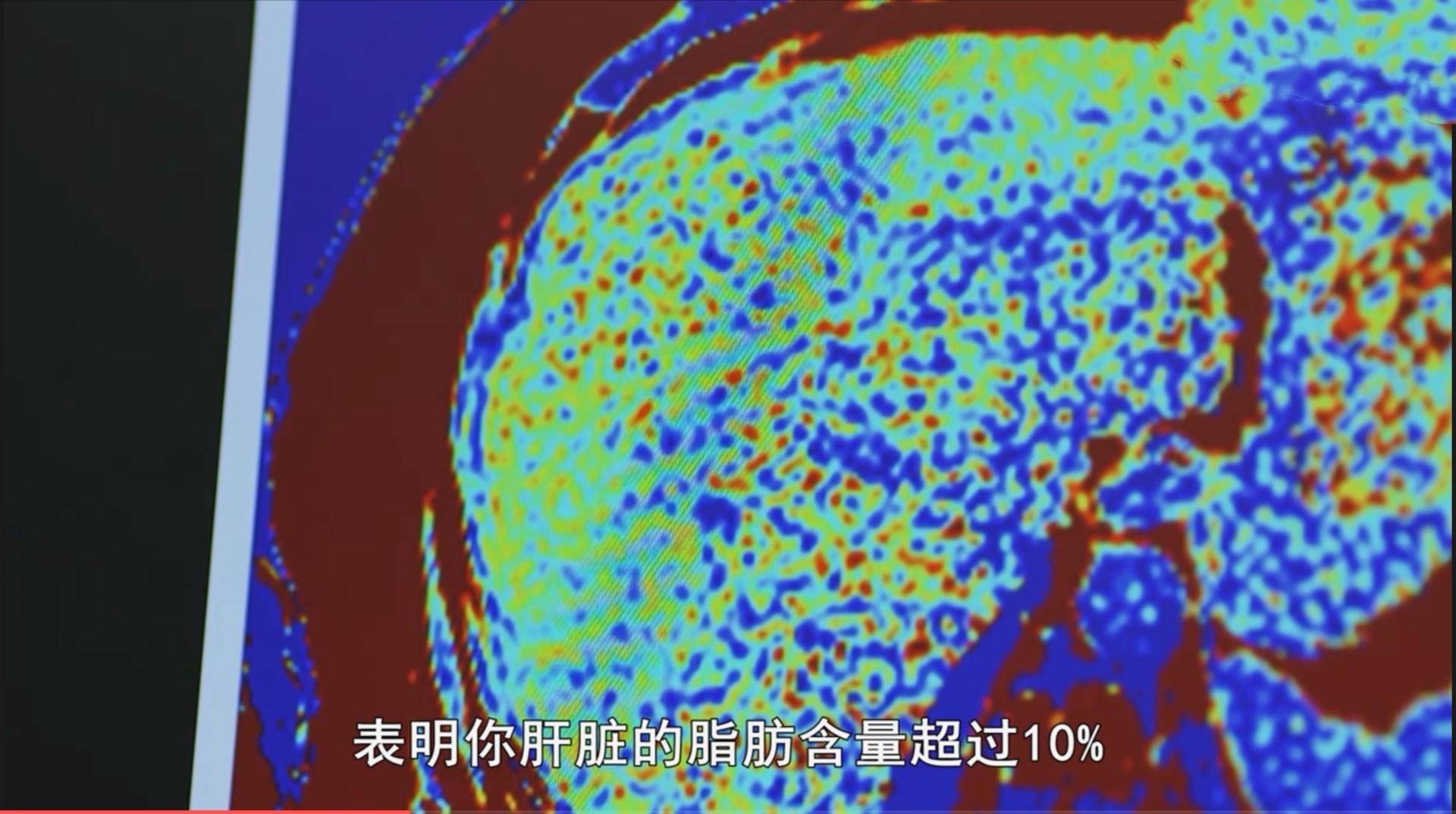 二十一天减肥法真实案例,最强减肥法科学