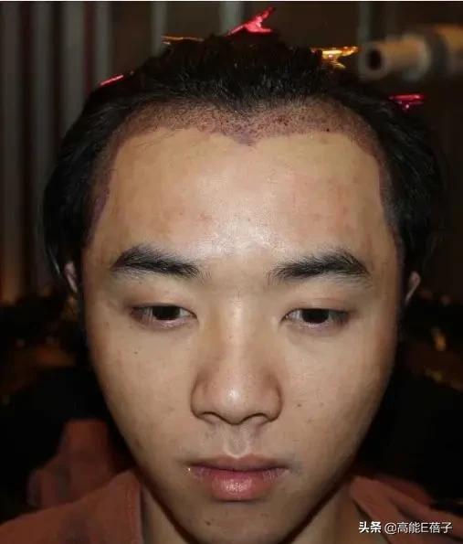 网友突然晒照曝华晨宇整容植发，还自称是其老婆，被张碧晨介入？