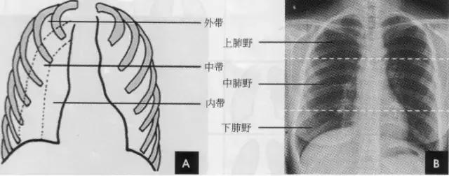 x线胸部解剖,胸部x线解读视频