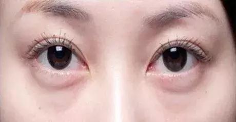 怎么挑选一款适合的眼霜,怎么选择一款适合自己的眼霜