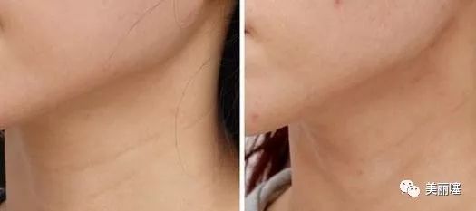 屈臣氏有兰蔻粉水,兰蔻粉水屈臣氏