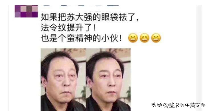 大小眼双眼皮能做眼综合手术吗,眼综合双眼皮全切