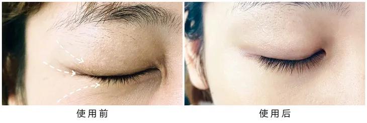 百年老牌马应龙又放大招，把眼纹收拾得服服帖帖，没有年龄感