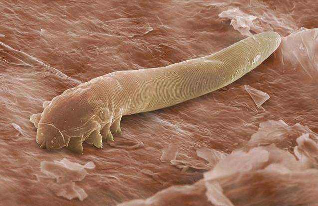 脸上长痘痘有白色脓包选什么药膏,脸上长痘痘怎么除螨