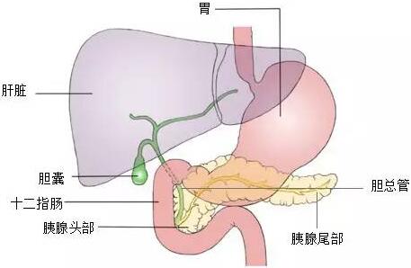 胆结石患者自述,泥沙型胆结石最坏的结果是怎样的