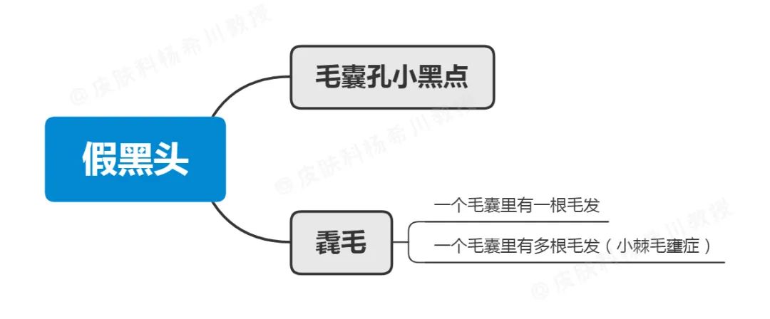 顽固黑头怎么去除最有效,祛除黑头最有效的方法