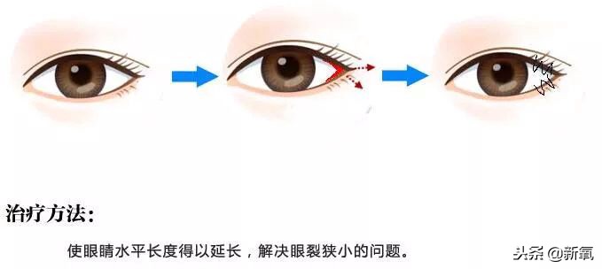 辛芷蕾是苦相女生吗,辛芷蕾气质怎么养成