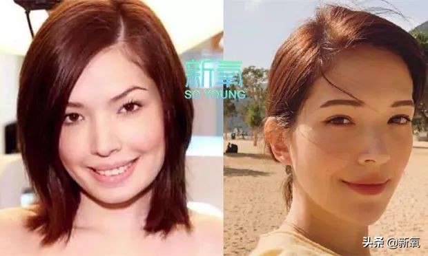 盘点整容后不敢认的女星颜值巅峰,知名女网红被扒整容
