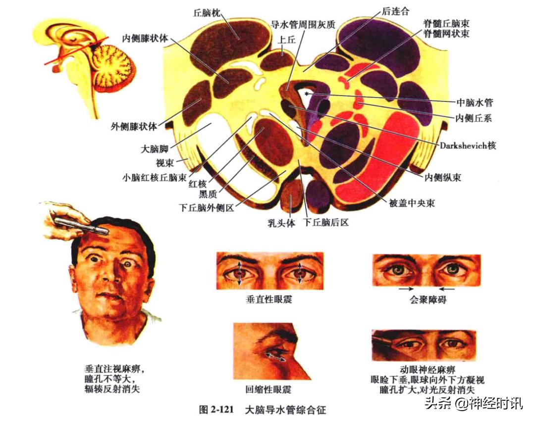 脑干解剖,脑干神经解剖