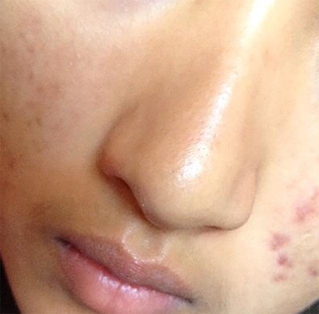 鼻子上挤出来的黄东西是什么,鼻子上挤出的黄色物体