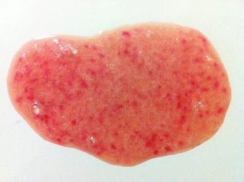 狗狗呕吐白色泡沫后又吐黄色粘液,狗狗吐了有什么方法治疗