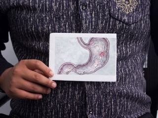 300000000肠胃疾病患者，都忽略了中医的外治技术