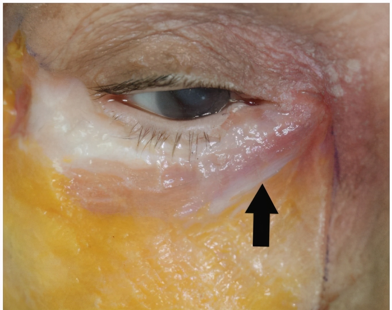 整形医生不会做手术怎么办,整形后遗症医生不会告诉你