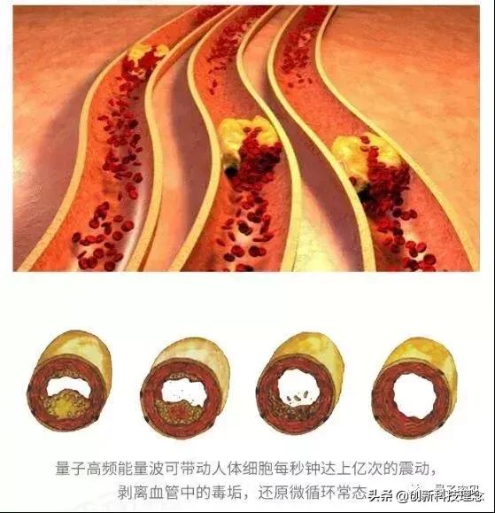 科学家发现量子穿梭效应,科学家发现引力波源