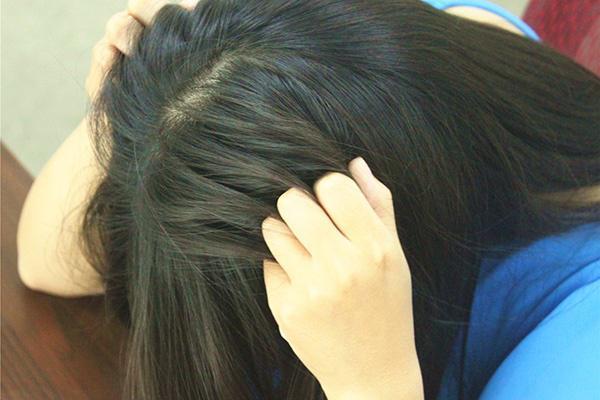 头皮发痒一抓就掉头发怎么回事,头皮痒一抓就起包咋回事