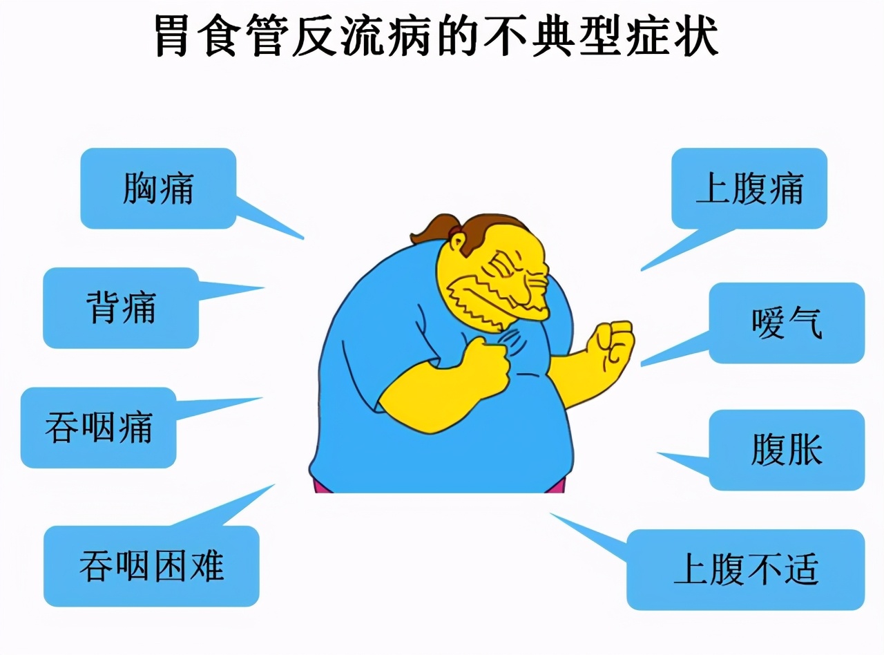 胃食管反流引起咽喉炎用药,孩子胃食管反流性咳嗽怎么用药