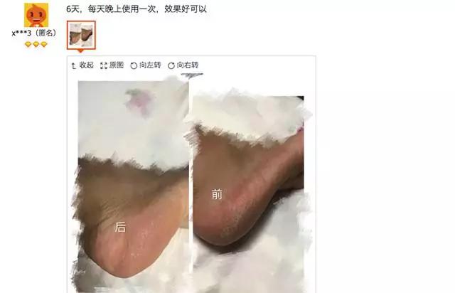澳洲顶级护脚膏,凡士林手足防裂膏妈妈用
