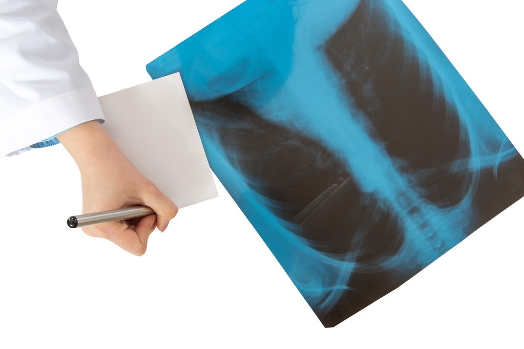 有支气管扩张能做胃镜检查吗,怀疑支气管异物拍什么检查