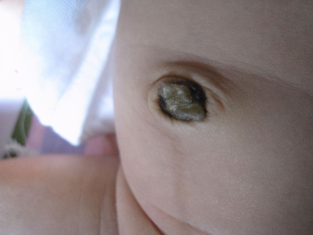 宝宝频繁清洗的危害,给宝宝清洁谨防过度