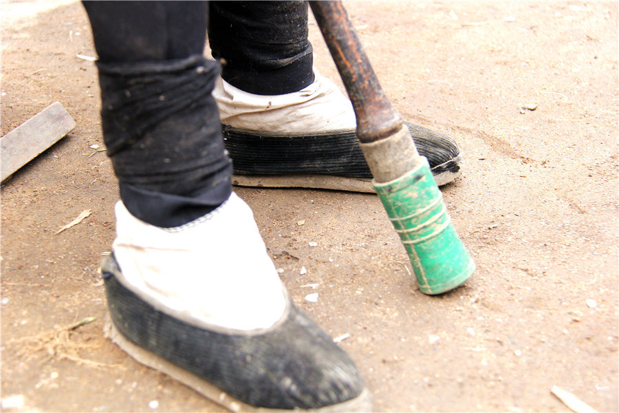 女人有轻微的自残现象,女人有自残现象