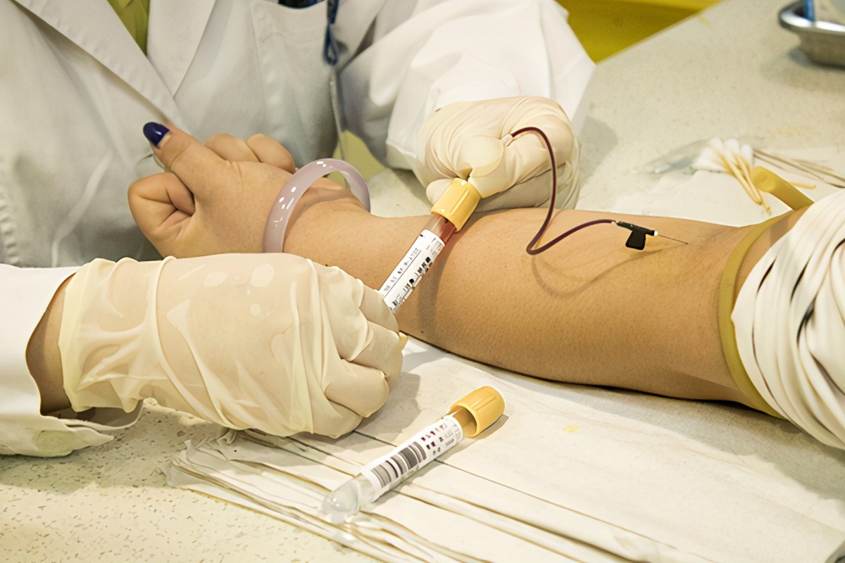 癌细胞死亡会引起癌胚抗原升高吗,癌细胞大量死亡癌胚抗原升高