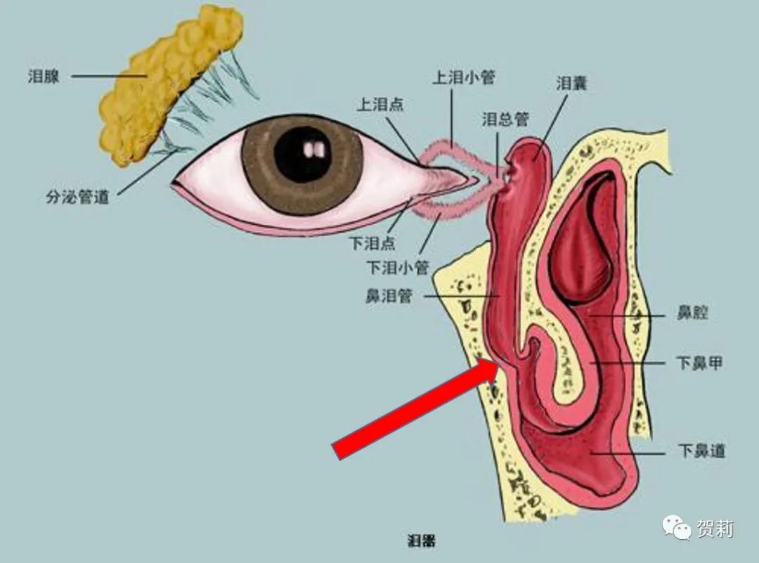 泪道狭窄和阻塞的相关知识,泪道狭窄阻塞怎么治