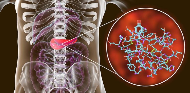 正确认识胰岛素及胰岛素新进展,胰岛素抵抗该如何减脂增肌