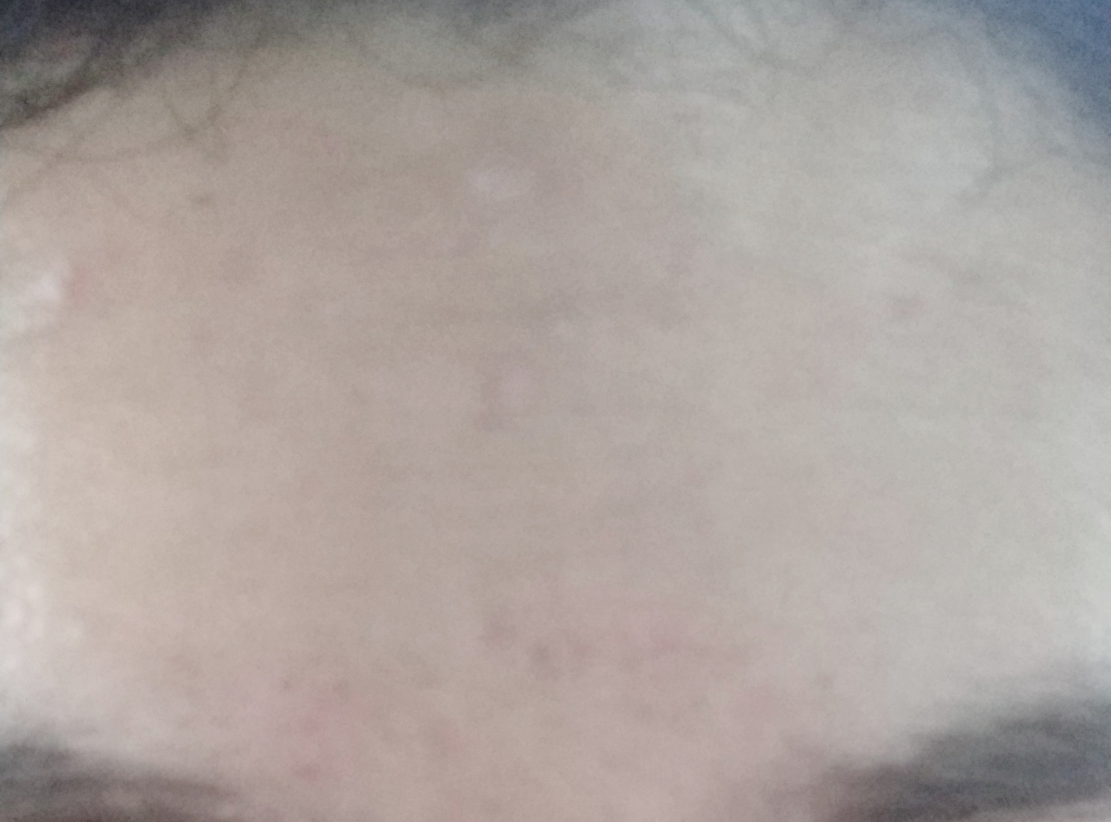 有哪些好用的祛痘印药膏 (超好用祛痘印药膏推荐一下)