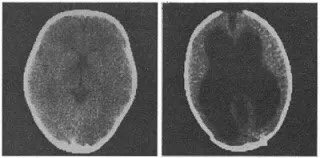 有没有被别人说脑子不好的科学家,被别人说没脑子高情商回复