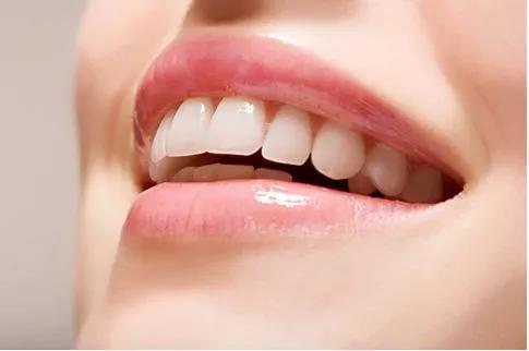 Helen齿科中心——全瓷贴面让你明眸皓齿不是梦