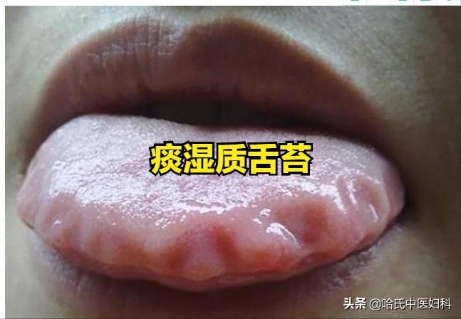 多囊卵巢综合征怀孕多久能测出来,多囊卵巢综合征怀孕了容易流产吗