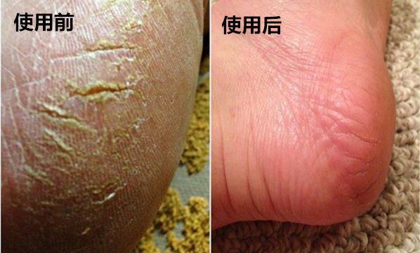 澳大利亚财政部长首推品牌,进国后让柳岩薇娅同时着迷,太疯狂了