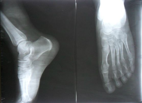 孩子比同龄人矮家长的误区,眼睁睁的看着父母老去却无能为力