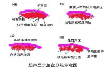 怀孕快七个月胎儿体重多少正常,怀孕36周胎儿发育标准