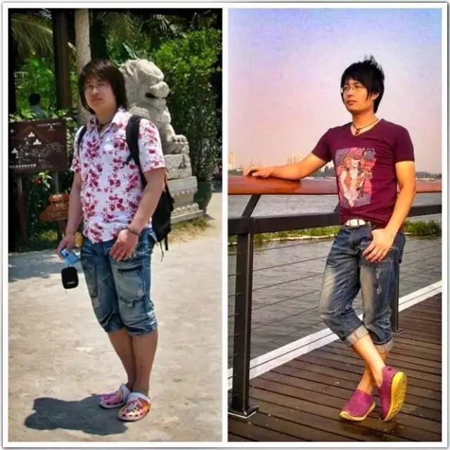 抽脂亲身经历回忆,抽脂血泪史