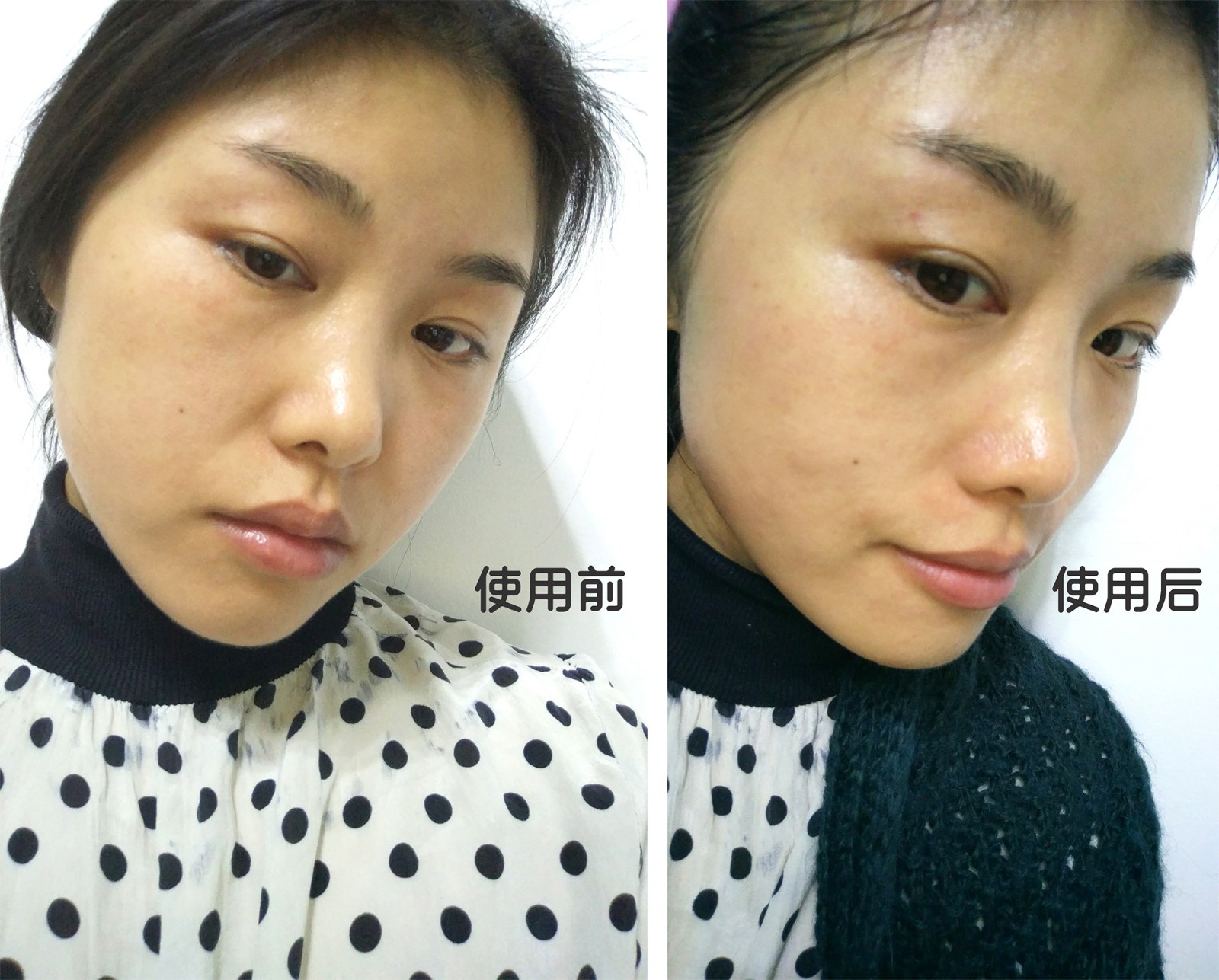 石墨烯美容黑科技，拥有了它，美了全家——若水石墨烯轻颜嫩肤仪