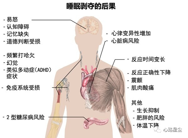 红酒治疗失眠的小妙招,睡觉前喝红酒有助于睡眠吗