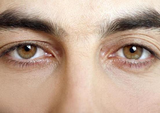 眼睛红有血丝预示着肝有问题吗,眼睛里血丝很重眼睛看起来很红