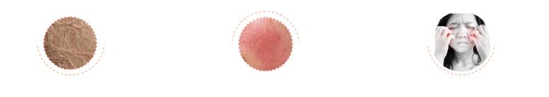 肌肤屏障受损抹什么护肤品都刺痛,皮肤屏障受损修复期间用什么保湿