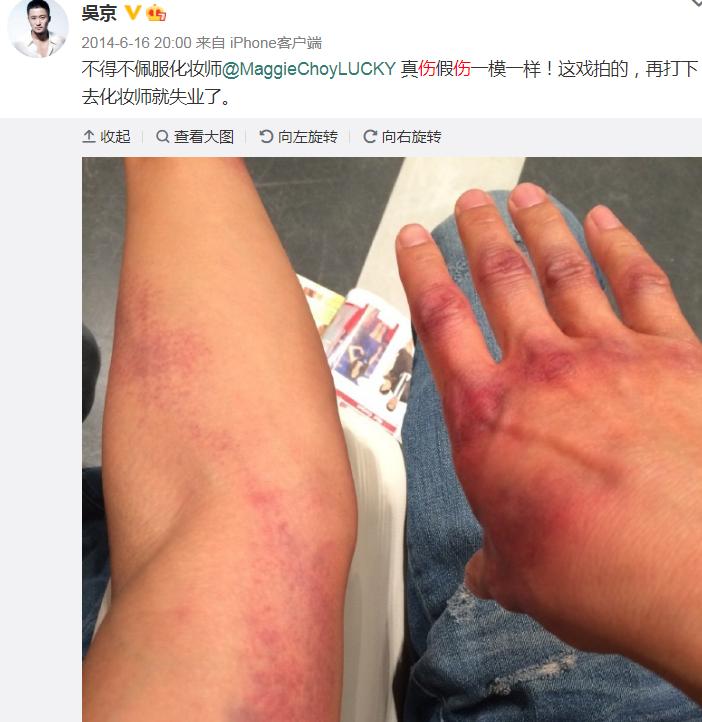 吴京全身缝针,吴京全身缝针高达100多针