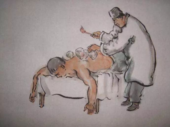 拔罐后为啥有的罐印有的深有的浅,拔罐对人是有好处还是有坏处