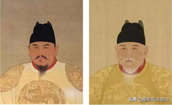 面中部凹陷下巴微翘,朱元璋式下巴怎么矫正