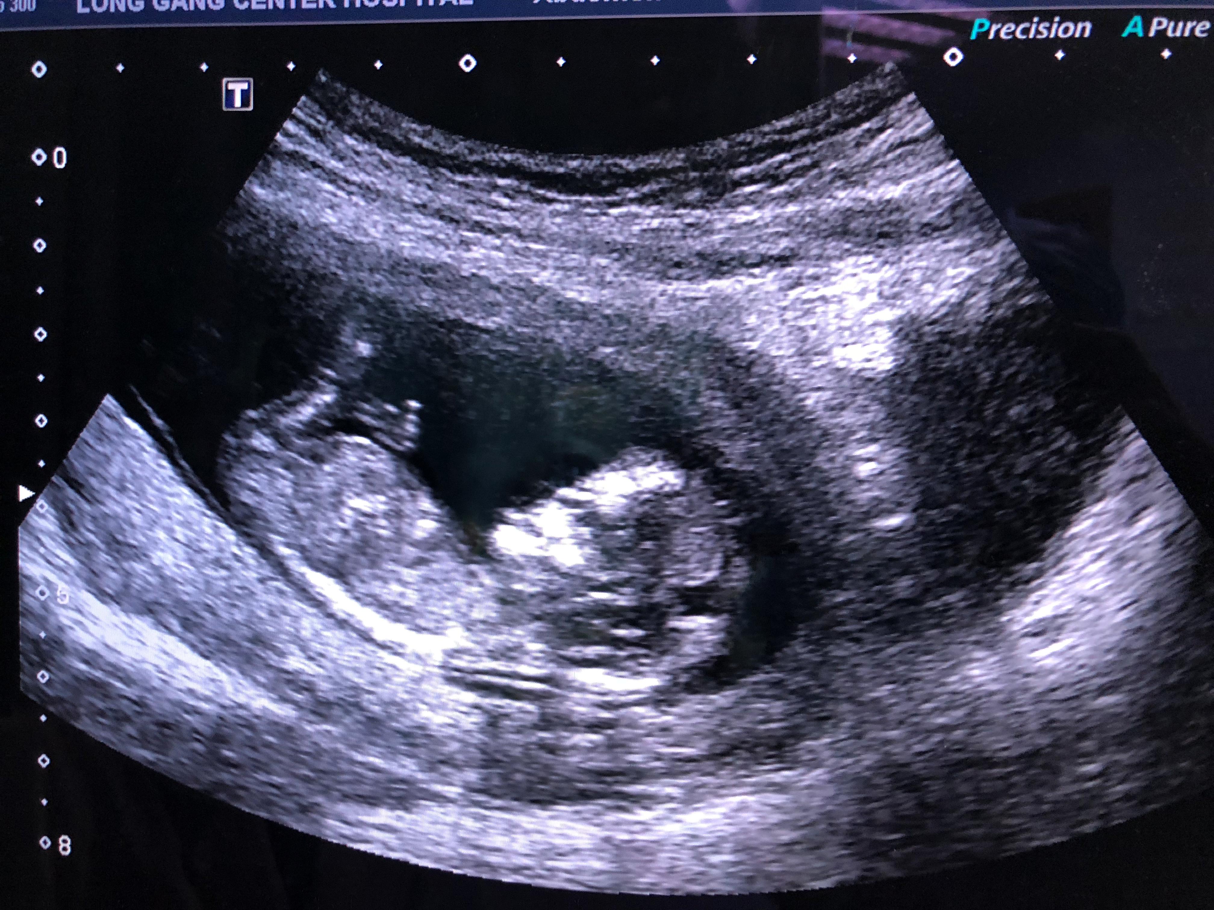 孕妈通俗易懂的产科知识,经验分享孕妈们必看