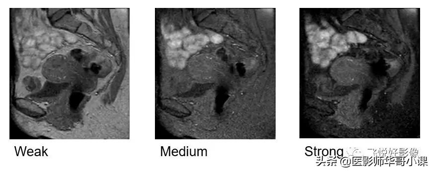 飞利浦磁共振独有技术,飞利浦磁共振减影技术