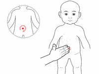 4岁宝宝腹泻拉土色大便怎么回事,宝宝腹泻之后便秘怎么回事