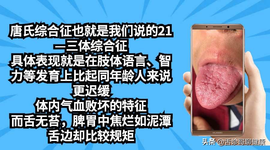 罗大伦舌诊图解肝郁气滞的舌象,抖音舌诊看体质