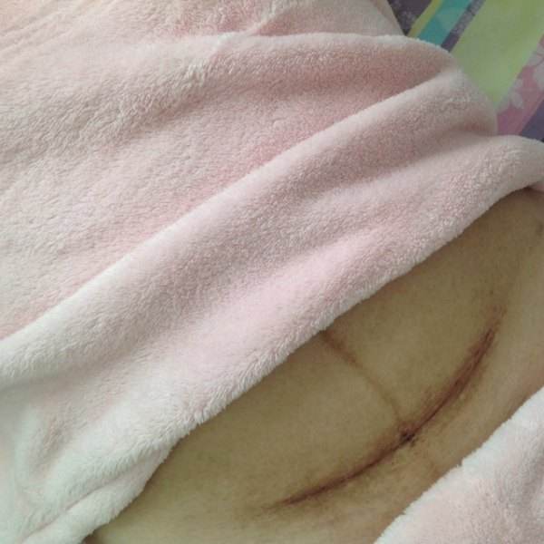 为何越来越多女性宁愿挨刀，也不愿选择顺产？原因不外乎这3点