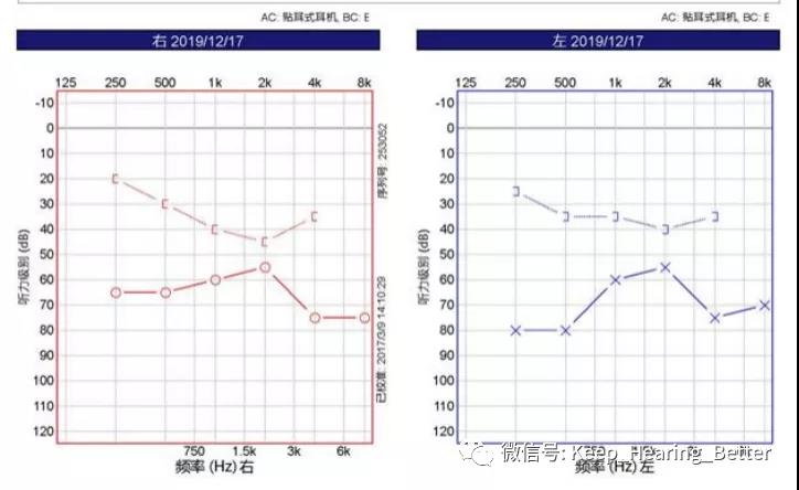 南大二附院,南大二附院耳鼻喉科专家